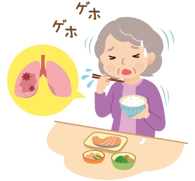 誤嚥性肺炎の予防は必要！症状や原因を知り食事時のリスクを減らそう